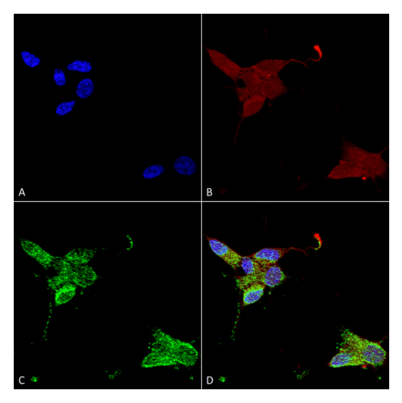 Immunocytochemistry/Immunofluorescence - Anti-TRPM7 Antibody [S74] (A304821) - Antibodies.com