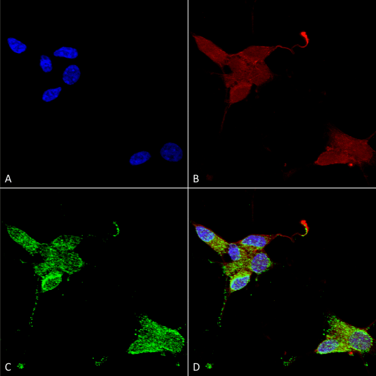 Immunocytochemistry/Immunofluorescence - Anti-TRPM7 Antibody [S74] (A304821) - Antibodies.com