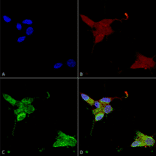 Immunocytochemistry/Immunofluorescence - Anti-TRPM7 Antibody [S74] (A304821) - Antibodies.com