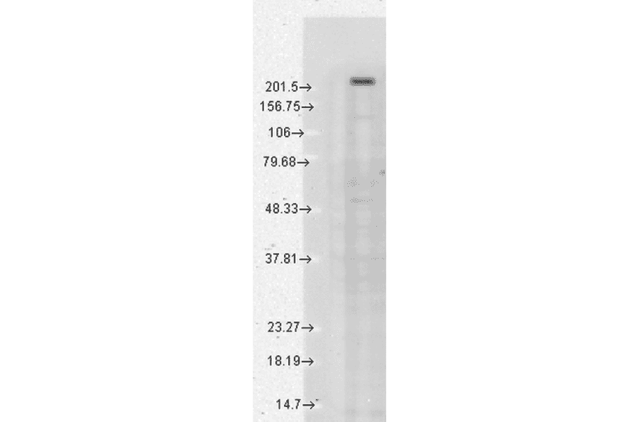 Western Blot - Anti-TRPM7 Antibody [S74] (A304821) - Antibodies.com