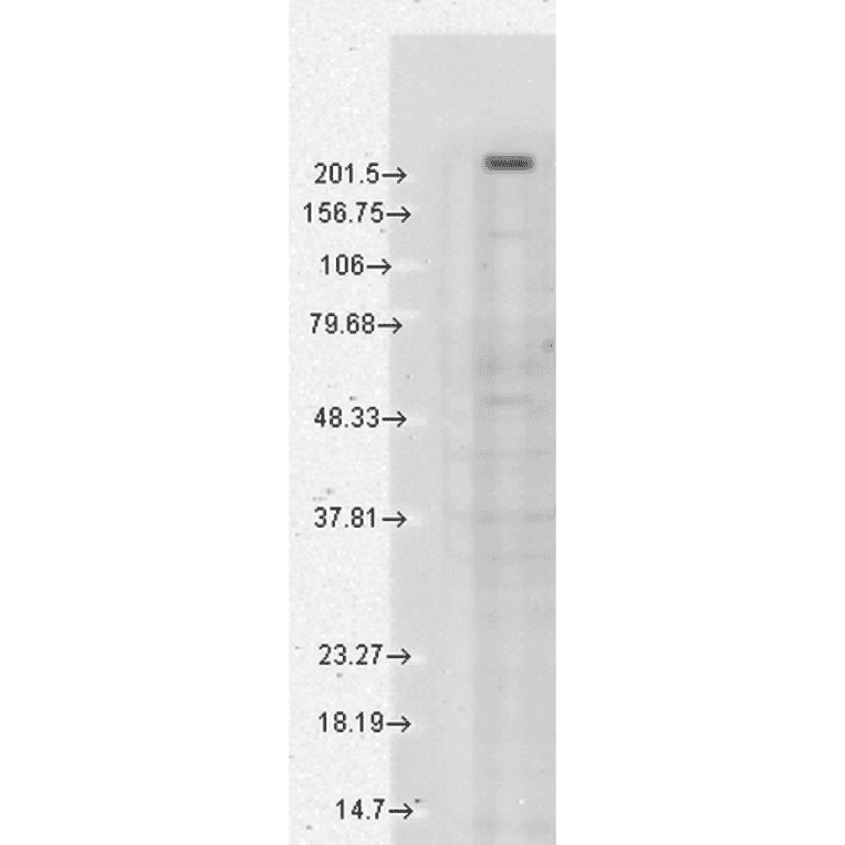 Western Blot - Anti-TRPM7 Antibody [S74] (A304821) - Antibodies.com