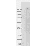 Western Blot - Anti-TRPM7 Antibody [S74] (A304821) - Antibodies.com