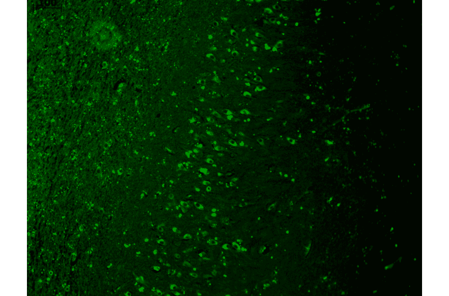Immunohistochemistry - Anti-TRPM7 Antibody [S74] (A304821) - Antibodies.com
