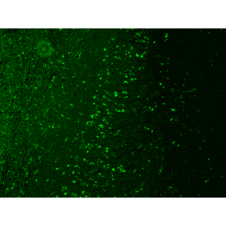 Immunohistochemistry - Anti-TRPM7 Antibody [S74] (A304821) - Antibodies.com