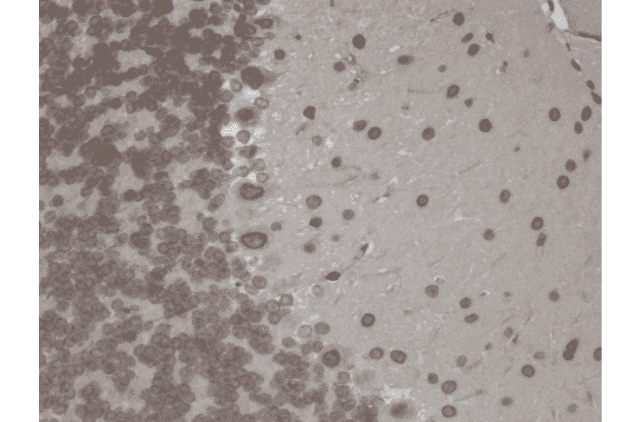 Immunohistochemistry - Anti-TRPM7 Antibody [S74] (A304821) - Antibodies.com