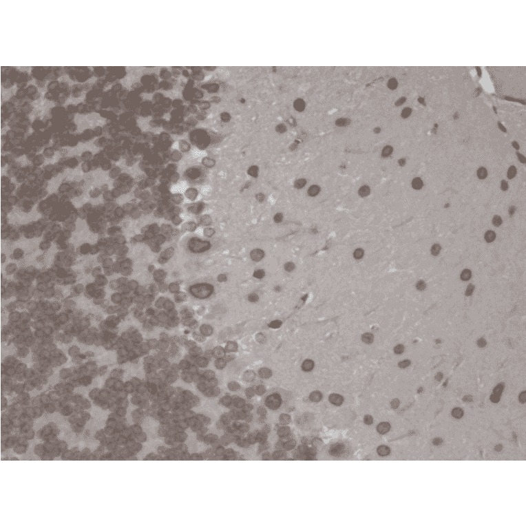 Immunohistochemistry - Anti-TRPM7 Antibody [S74] (A304821) - Antibodies.com