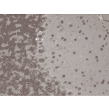 Immunohistochemistry - Anti-TRPM7 Antibody [S74] (A304821) - Antibodies.com