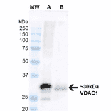 Western Blot - Anti-VDAC1 / Porin Antibody [S152B-23] (A304822) - Antibodies.com