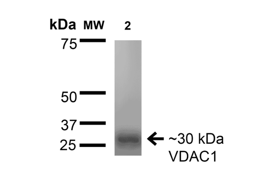 Western Blot - Anti-VDAC1 / Porin Antibody [S152B-23] (A304822) - Antibodies.com