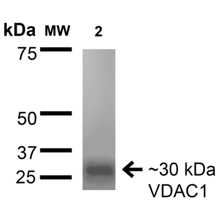Western Blot - Anti-VDAC1 / Porin Antibody [S152B-23] (A304822) - Antibodies.com