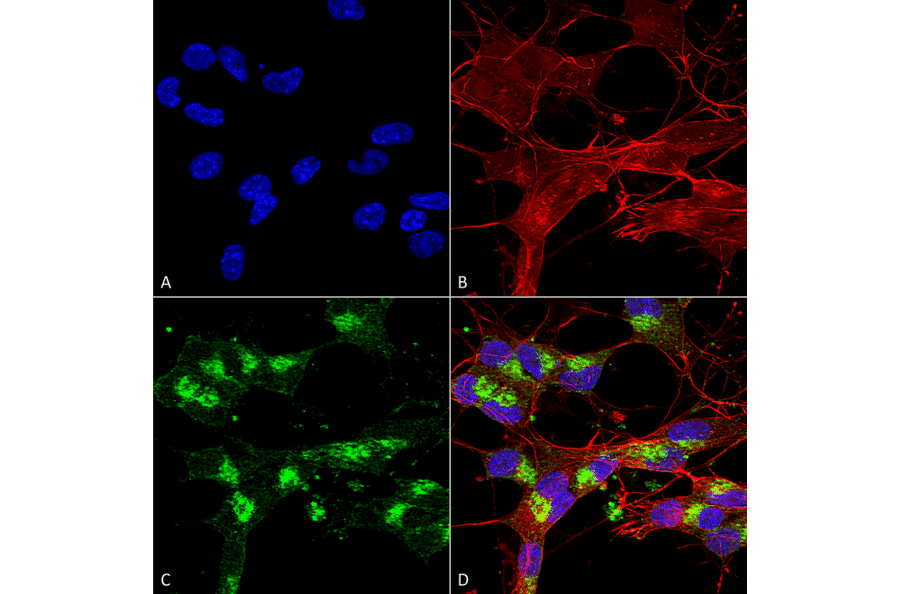 Immunocytochemistry/Immunofluorescence - Anti-VDAC1 / Porin Antibody [S152B-23] (A304822) - Antibodies.com