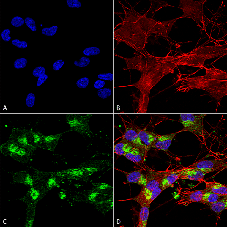 Immunocytochemistry/Immunofluorescence - Anti-VDAC1 / Porin Antibody [S152B-23] (A304822) - Antibodies.com