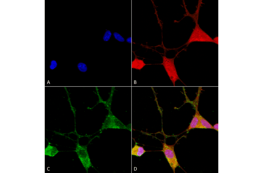 Immunocytochemistry/Immunofluorescence - Anti-VGluT1 Antibody [S28-9] (A304823) - Antibodies.com