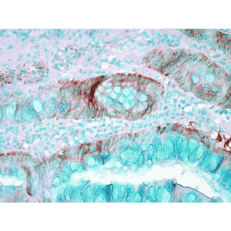 Immunohistochemistry - Anti-HSP70 Antibody (A304824) - Antibodies.com