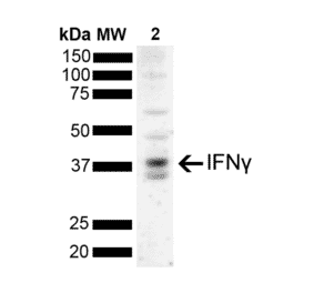 Western Blot - Anti-IFN gamma Antibody [N2P2D5-A10] (A304834) - Antibodies.com