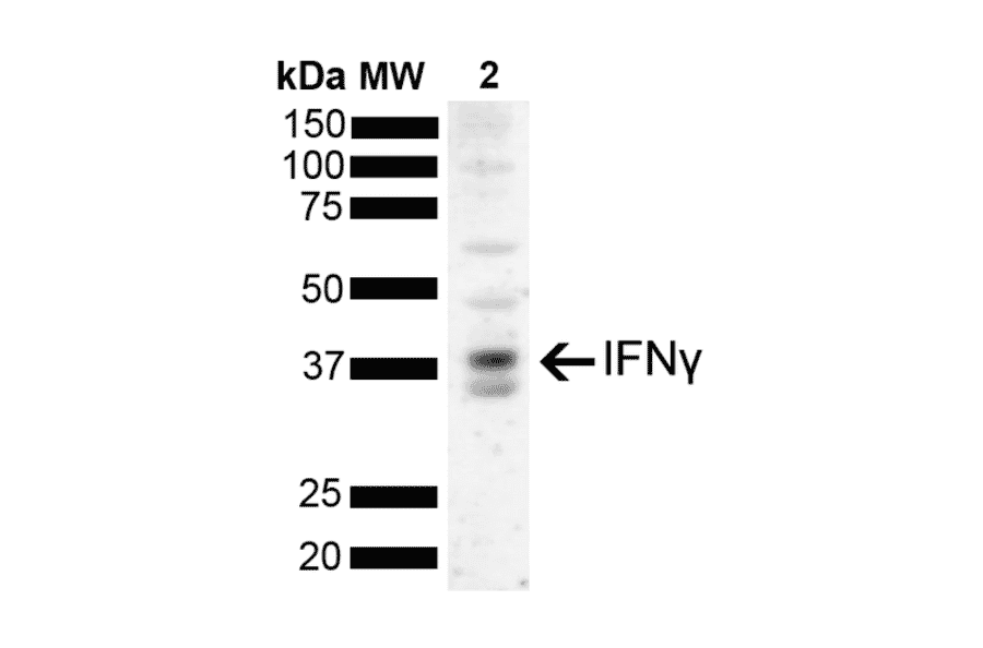 Western Blot - Anti-IFN gamma Antibody [N2P2D5-A10] (A304834) - Antibodies.com