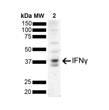 Western Blot - Anti-IFN gamma Antibody [N2P2D5-A10] (A304834) - Antibodies.com