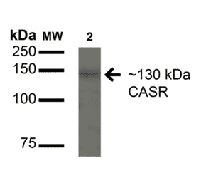 Western Blot - Anti-CaSR Antibody (A304836) - Antibodies.com