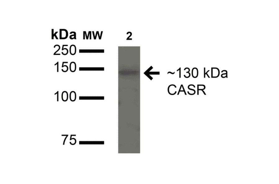 Western Blot - Anti-CaSR Antibody (A304836) - Antibodies.com