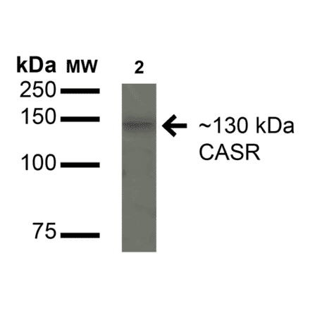 Western Blot - Anti-CaSR Antibody (A304836) - Antibodies.com