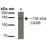 Western Blot - Anti-CaSR Antibody (A304836) - Antibodies.com