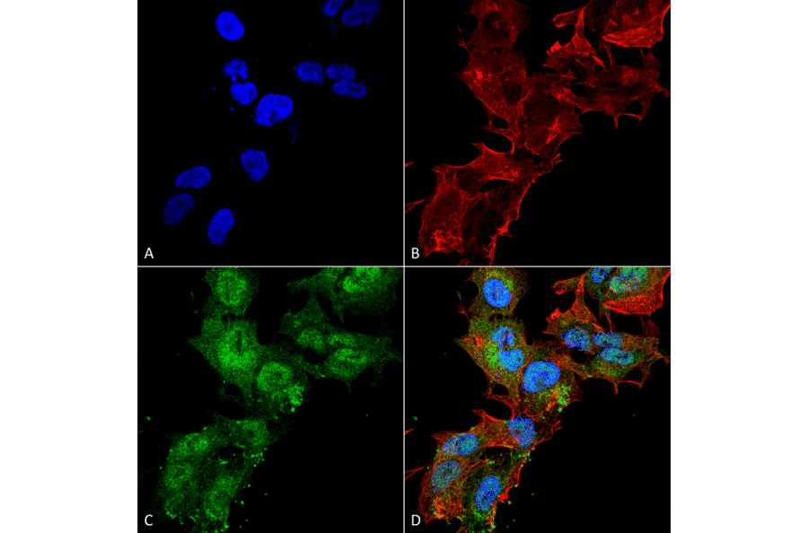Immunocytochemistry/Immunofluorescence - Anti-CaSR Antibody (A304836) - Antibodies.com