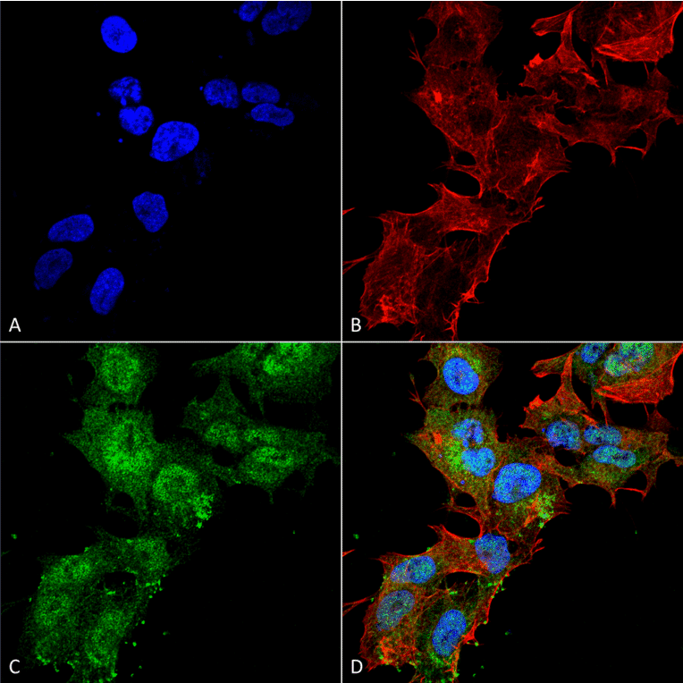 Immunocytochemistry/Immunofluorescence - Anti-CaSR Antibody (A304836) - Antibodies.com