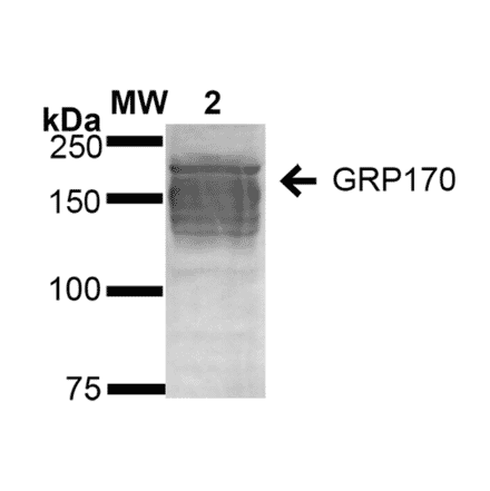 Western Blot - Anti-ORP150 Antibody [6G7-2H5] (A304837) - Antibodies.com