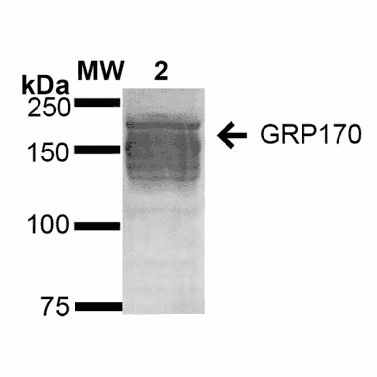 Western Blot - Anti-ORP150 Antibody [6G7-2H5] (A304837) - Antibodies.com
