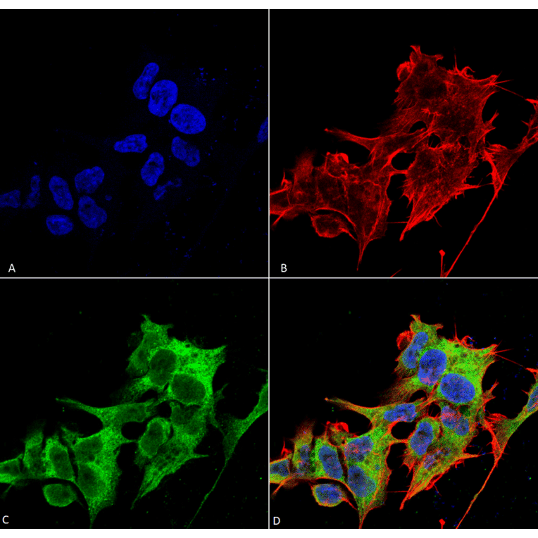 Immunocytochemistry/Immunofluorescence - Anti-ORP150 Antibody [6G7-2H5] (A304837) - Antibodies.com