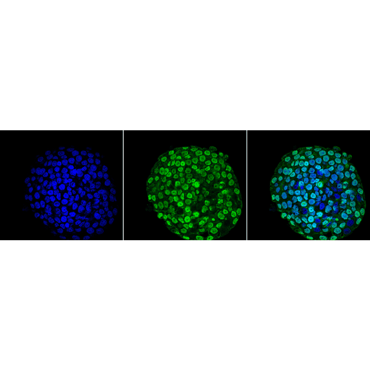 Immunocytochemistry/Immunofluorescence - Anti-CENPA Antibody [5A7-2E11] (A304838) - Antibodies.com