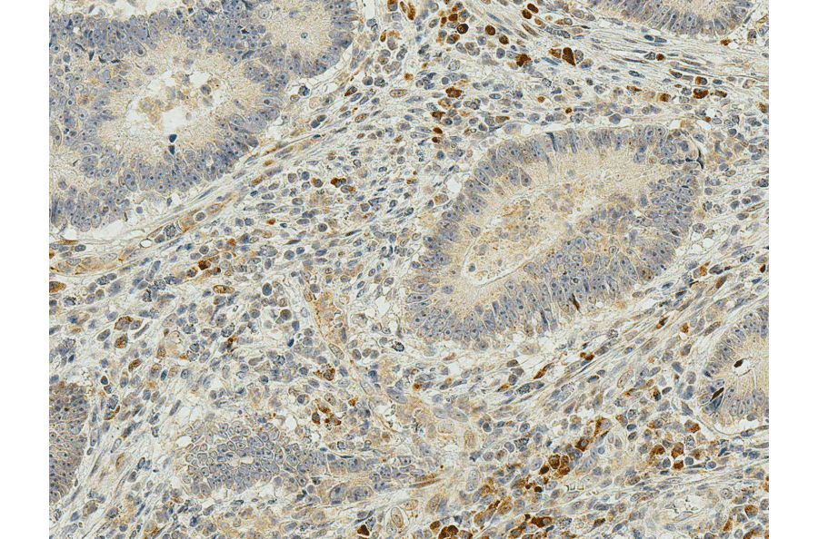 Immunohistochemistry - Anti-IRGM Antibody (A304839) - Antibodies.com