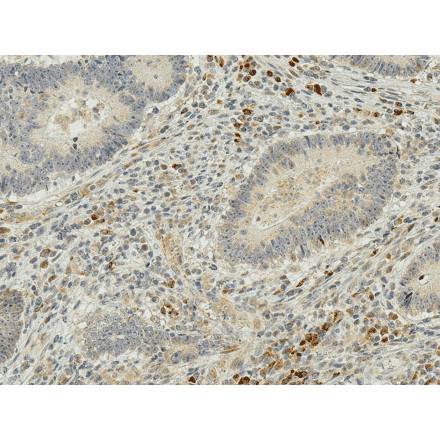 Immunohistochemistry - Anti-IRGM Antibody (A304839) - Antibodies.com