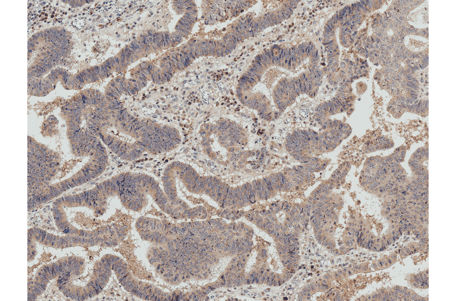 Immunohistochemistry - Anti-IRGM Antibody (A304839) - Antibodies.com