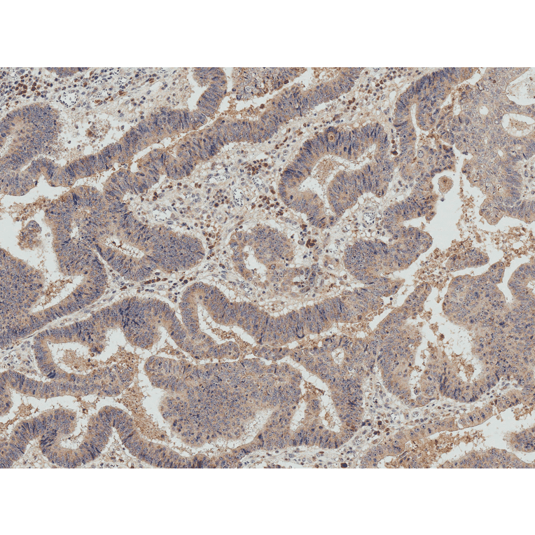 Immunohistochemistry - Anti-IRGM Antibody (A304839) - Antibodies.com