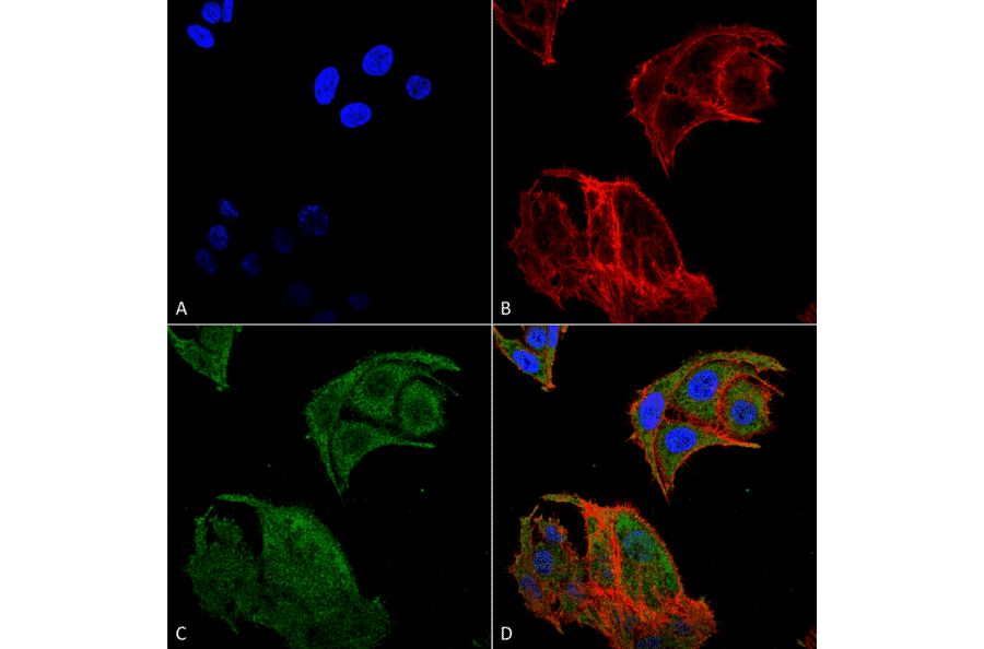 Immunocytochemistry/Immunofluorescence - Anti-IRGM Antibody (A304839) - Antibodies.com