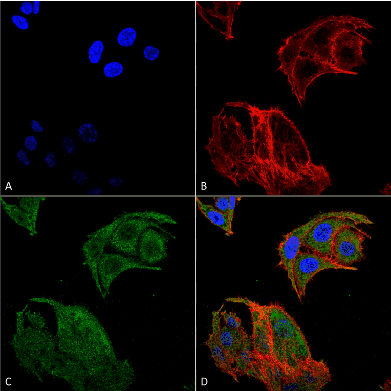 Immunocytochemistry/Immunofluorescence - Anti-IRGM Antibody (A304839) - Antibodies.com