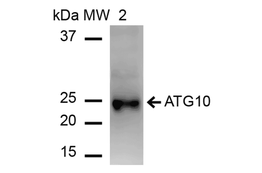 Western Blot - Anti-ATG10 Antibody (A304840) - Antibodies.com