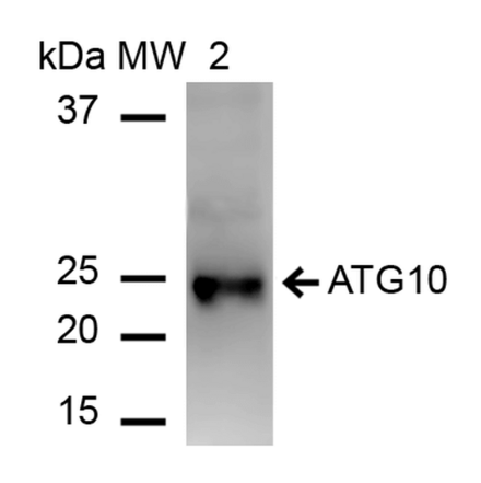 Western Blot - Anti-ATG10 Antibody (A304840) - Antibodies.com