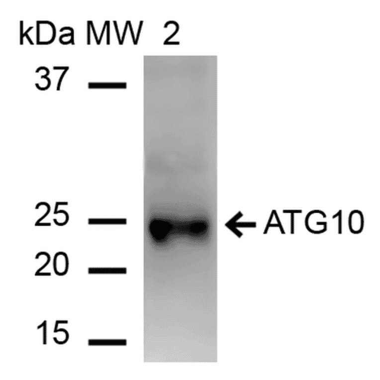 Western Blot - Anti-ATG10 Antibody (A304840) - Antibodies.com