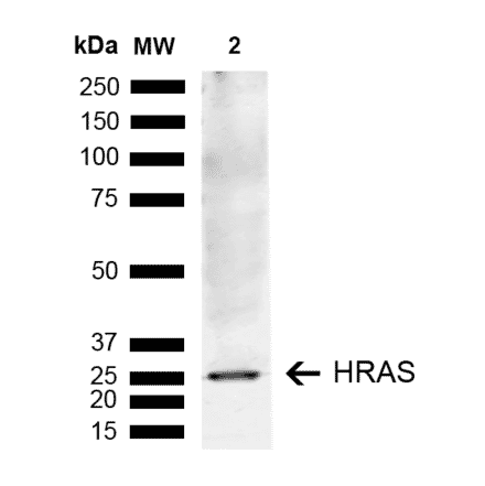 Western Blot - Anti-GTPase HRAS Antibody (A304841) - Antibodies.com