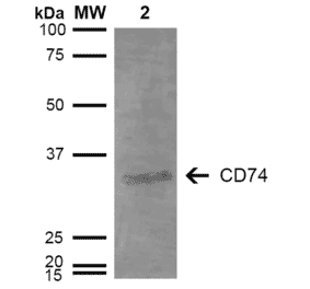 Western Blot - Anti-CD74 Antibody [3D7] (A304842) - Antibodies.com