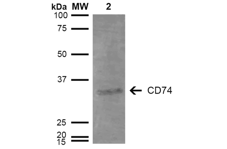 Western Blot - Anti-CD74 Antibody [3D7] (A304842) - Antibodies.com