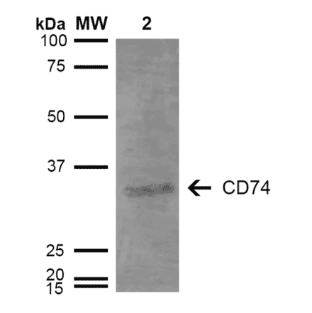 Western Blot - Anti-CD74 Antibody [3D7] (A304842) - Antibodies.com