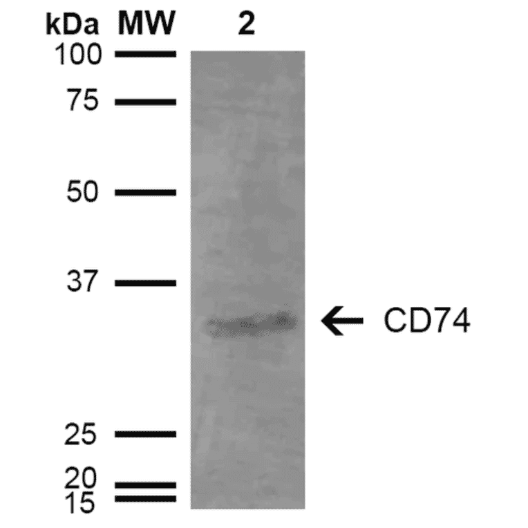 Western Blot - Anti-CD74 Antibody [3D7] (A304842) - Antibodies.com