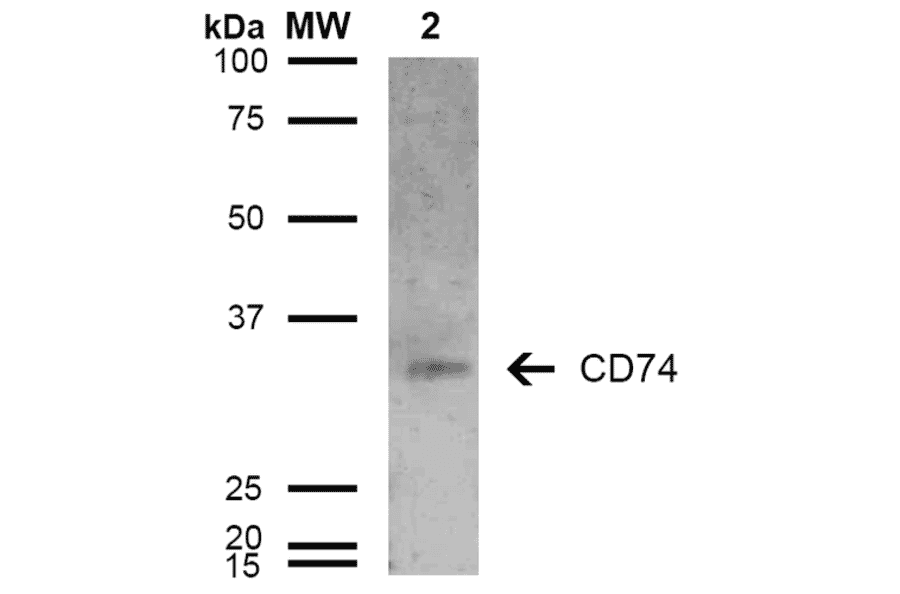 Western Blot - Anti-CD74 Antibody [6D9] (A304843) - Antibodies.com