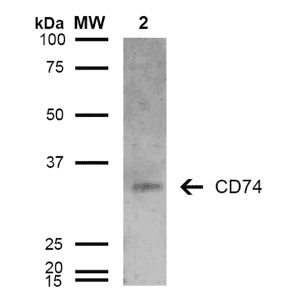 Western Blot - Anti-CD74 Antibody [6D9] (A304843) - Antibodies.com