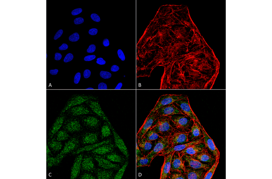 Immunocytochemistry/Immunofluorescence - Anti-CD74 Antibody [6D9] (A304843) - Antibodies.com