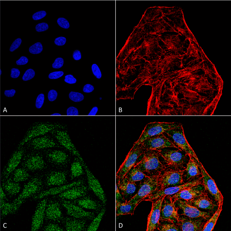 Immunocytochemistry/Immunofluorescence - Anti-CD74 Antibody [6D9] (A304843) - Antibodies.com