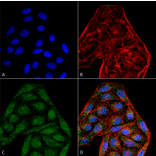 Immunocytochemistry/Immunofluorescence - Anti-CD74 Antibody [6D9] (A304843) - Antibodies.com